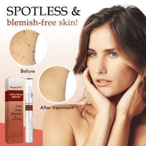đBUY 1 GET 1 FREEđWipeOff⢠Tags & Moles Remover - Emporium Shop