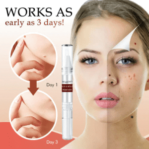 đBUY 1 GET 1 FREEđWipeOff⢠Tags & Moles Remover - Emporium Shop